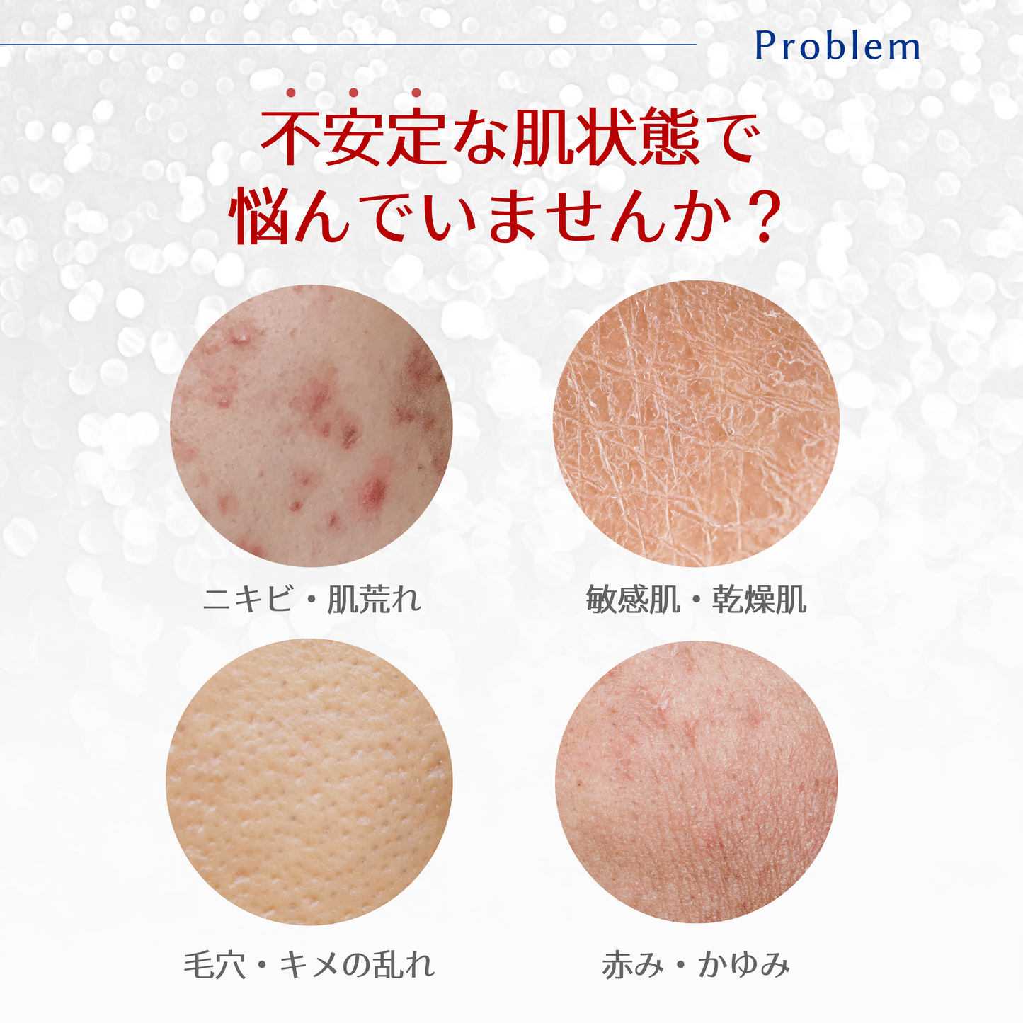 ステムソリューションセラム　